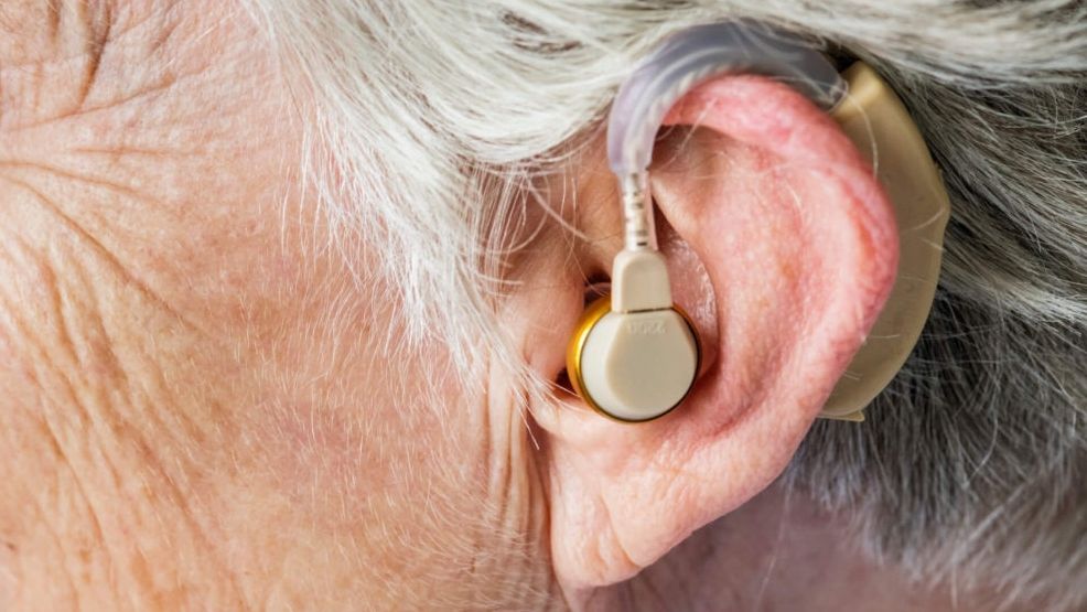 637e4be183878dcfb9d950f7_img-audifono-invisible-vs-sonotone